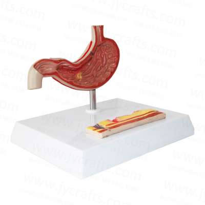 Learning Resources Anatomy gastrohelcosis stomach Model Classroom Demonstration Tools, Teacher Accessories