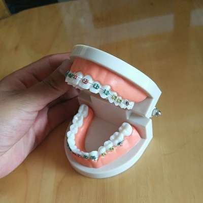 high quality science education typodont dental teeth model with braces